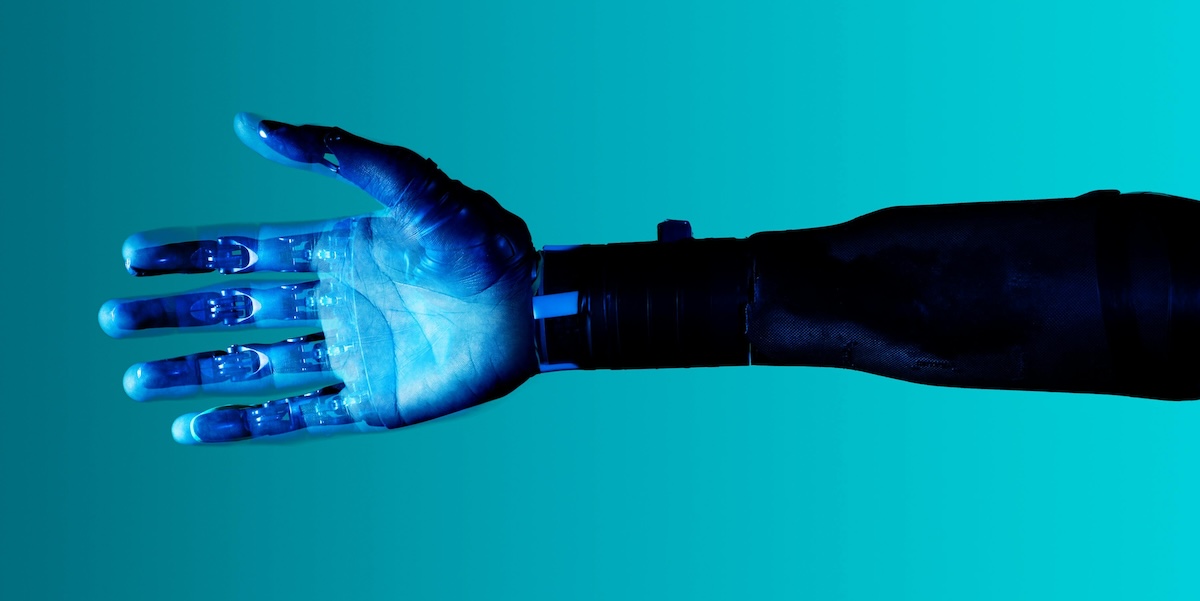 Automation Doesn't Replace Bookkeepers — It Exposes Bad Systems